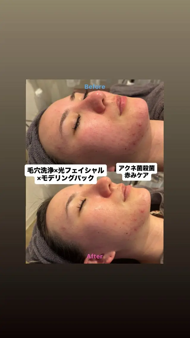 エステ 韓国肌管理 Mikiのエステ・リラクイメージ