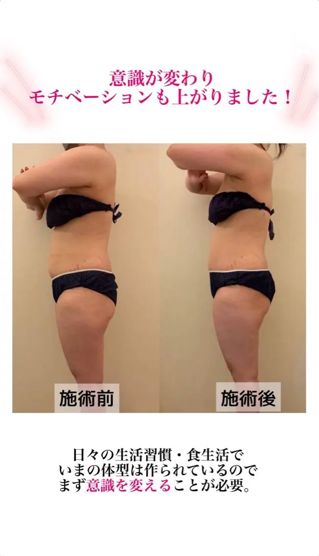 産後ダイエット−9㎏ Pourvous結衣のエステ・リラクイメージ