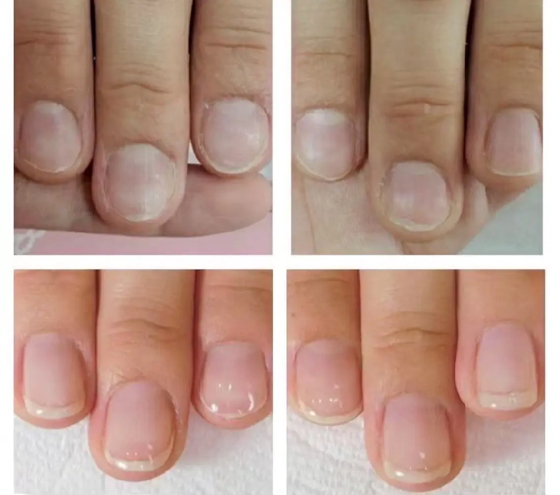 ネイル hana.nail 自爪育成サロンのネイルデザイン