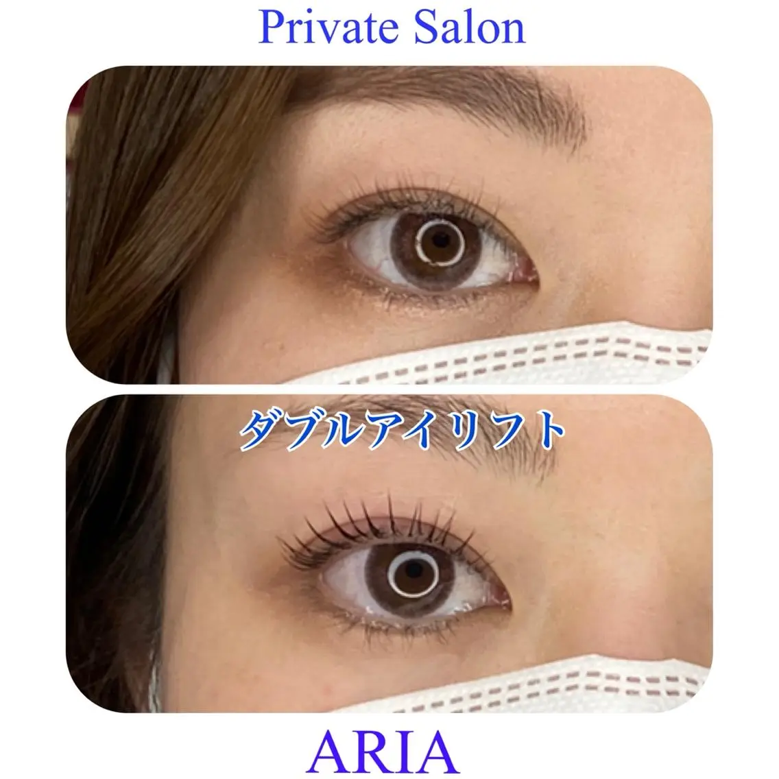 ダブルアイリフト✨骨膜アイストレッチ✖︎毛穴矯正パーマで二重線をよりサポート✨注意事項を必ずご確認下さいの写真
