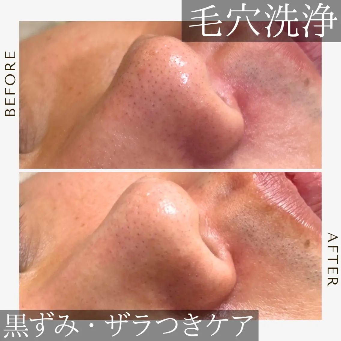 《美肌･小顔》美容鍼 ＆マッサージ＊MEIのエステ・リラクイメージ