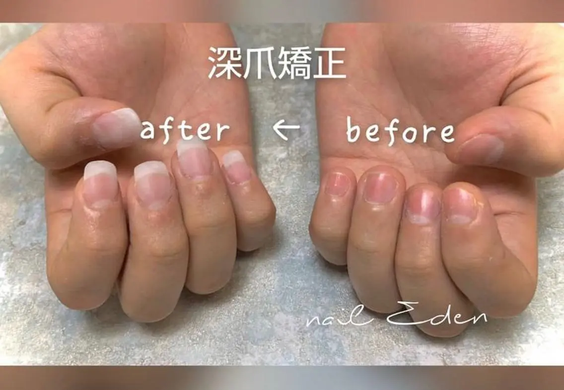 ネイル アートネイル クリアネイル 長さ出し フットネイル フレンチネイル Eden ♾️のネイルデザイン