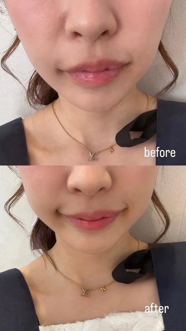 新導入  大人気ピンクトーン👄の写真