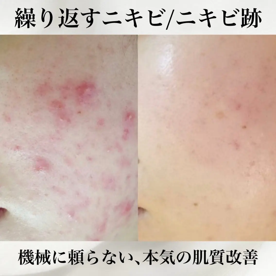 エステ 肌質改善×癒しサロン Ryanのエステ・リラクイメージ