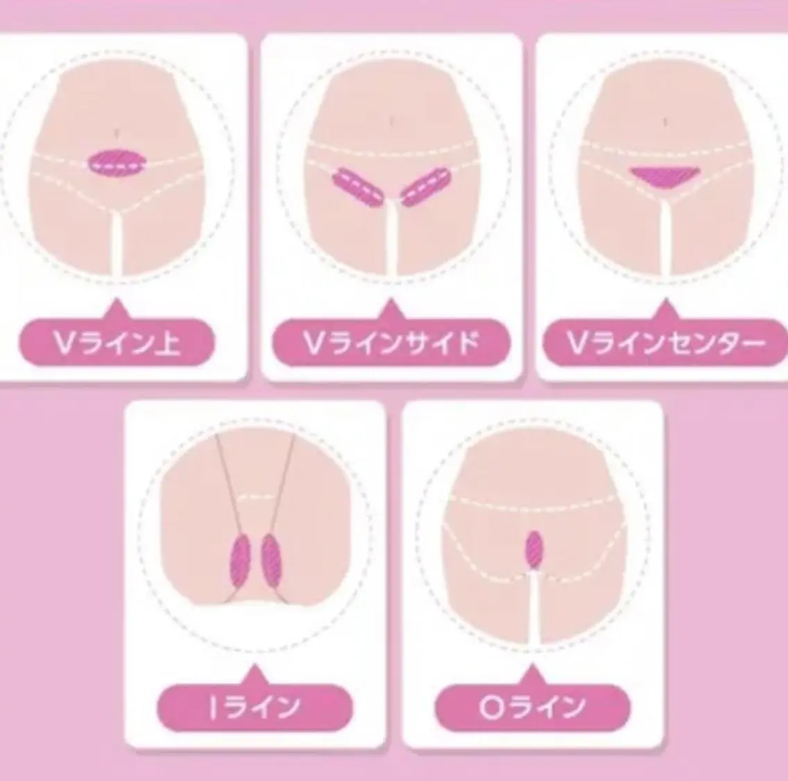 ⛄️VIO美肌脱毛⛄️冷却機能・デザイン自由👌本気で毛をなくしたい方必見💍目指せ自己処理いらず肌🌟の写真