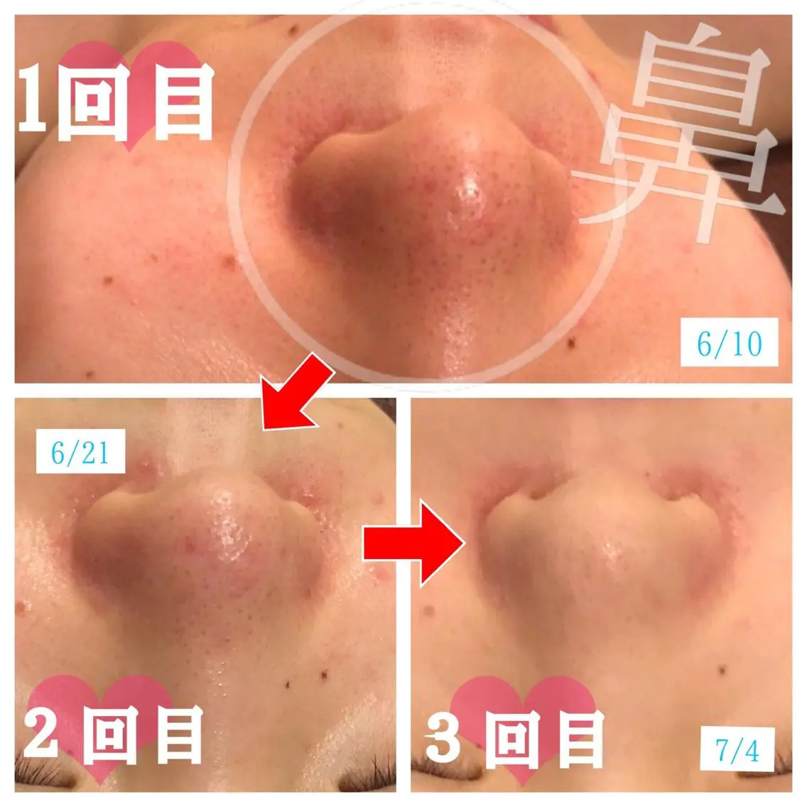 セミロング カラー パーマ ヘアアレンジ メンズ キッズ ネイル マツエク・マツパ 金の糸脱毛 産毛ケア専門のエステ・リラクイメージ