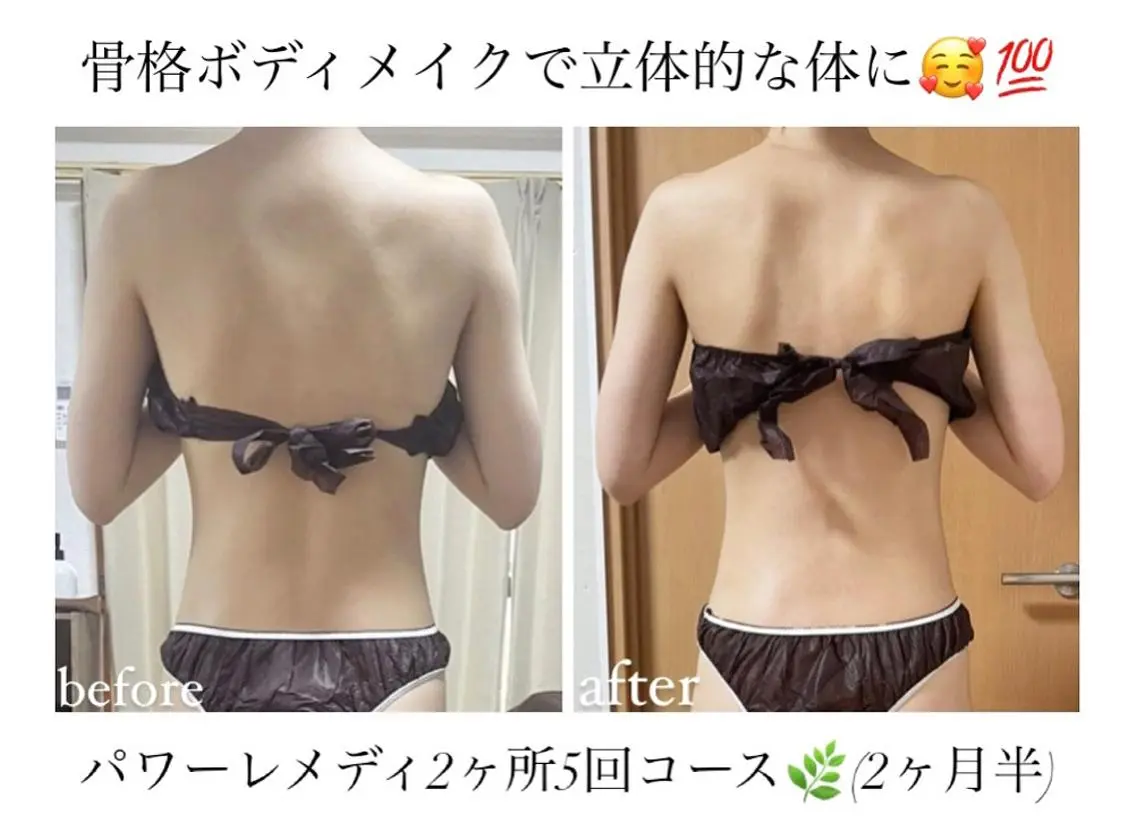 《本気痩せ×疲労改善 》 BILOOPのエステ・リラクイメージ