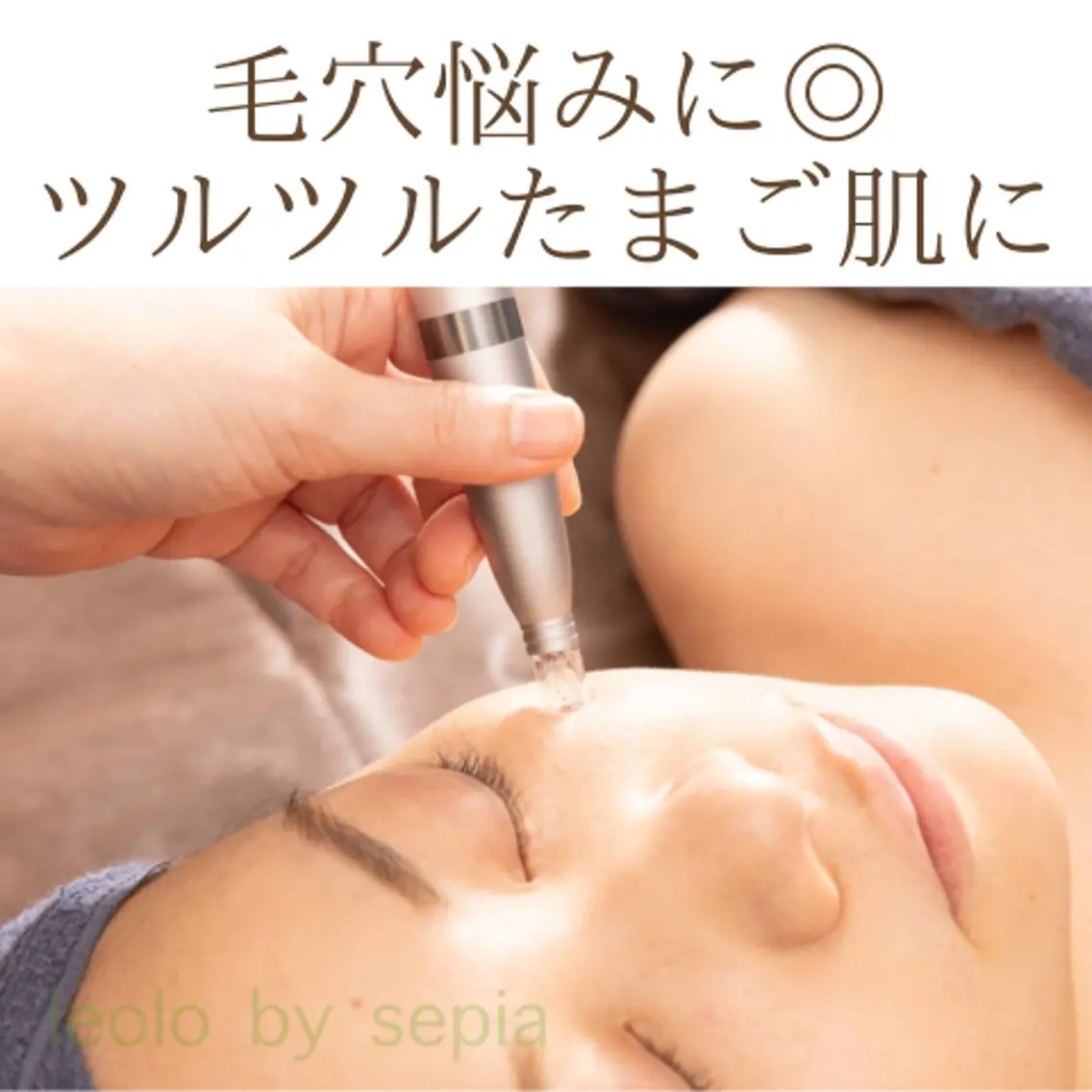 【初回】ダーマペンで毛穴レス透明肌体験♡毛穴・凹凸悩みの方大歓迎✨肌質改善💎ダウンタイムなし!の写真