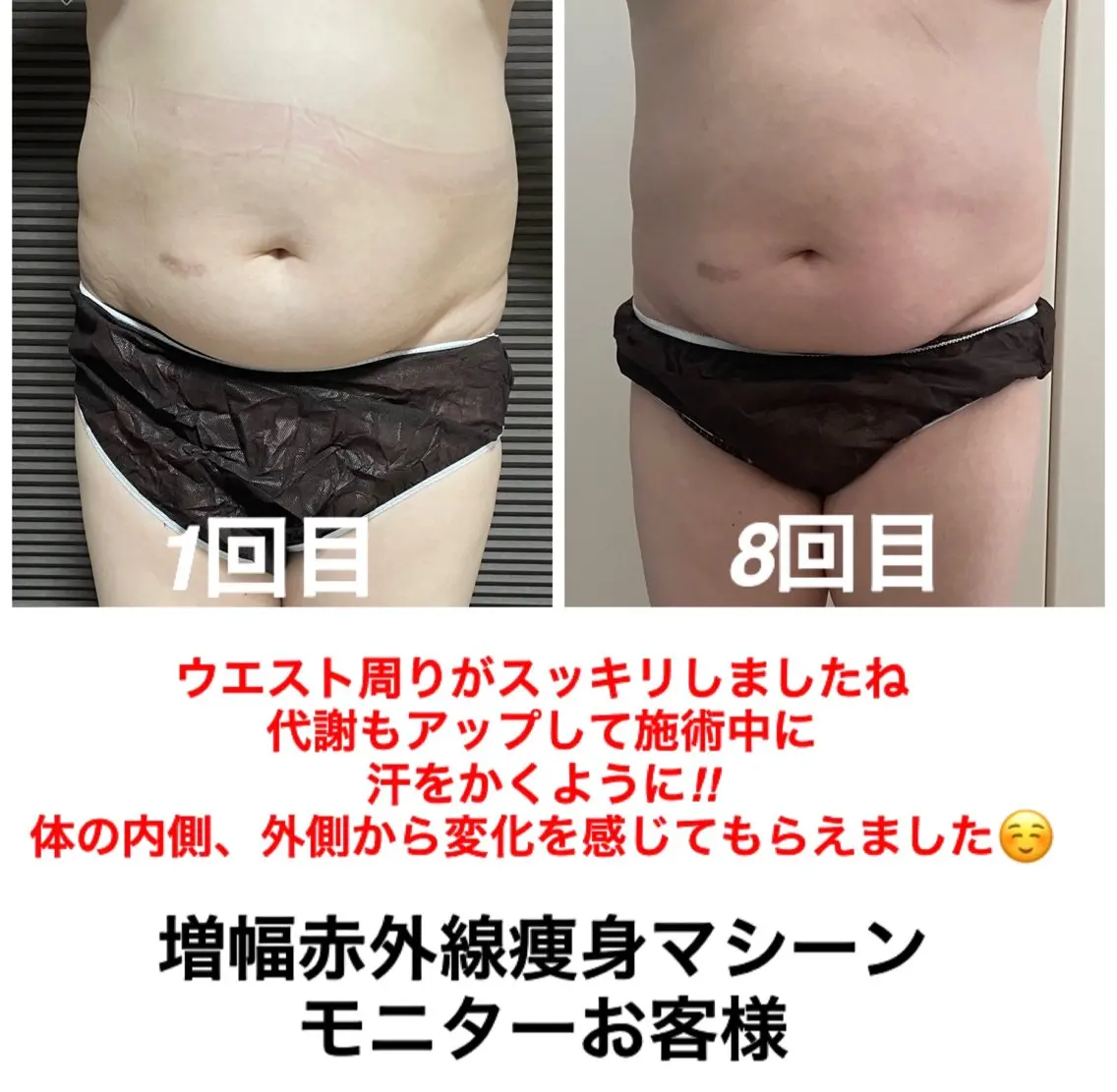 ネイル・エステサロン UILANIのエステ・リラクイメージ
