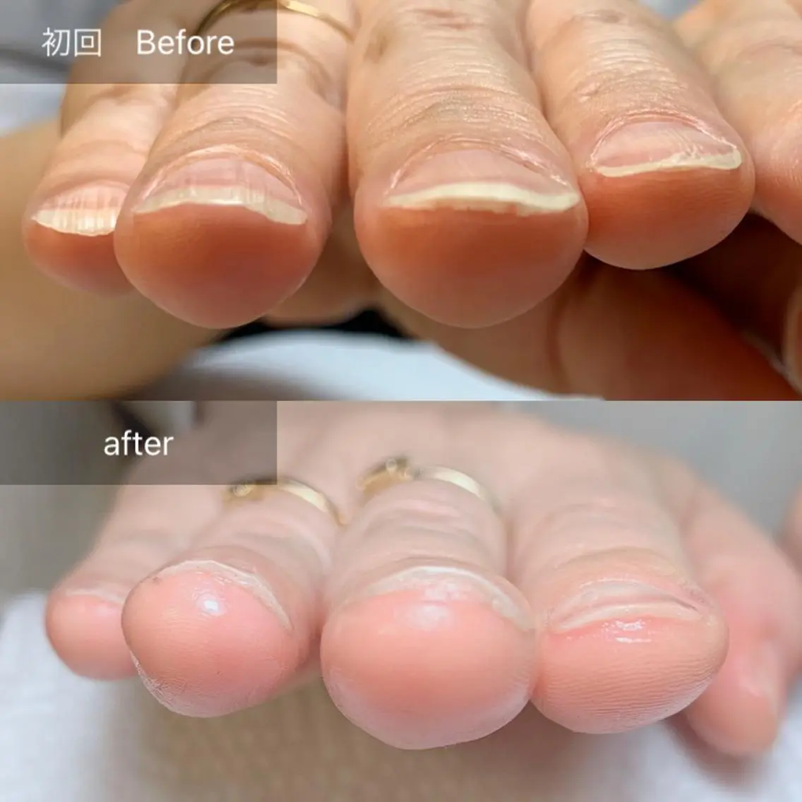ネイル その他(ネイル) 木村 千晴のネイルデザイン