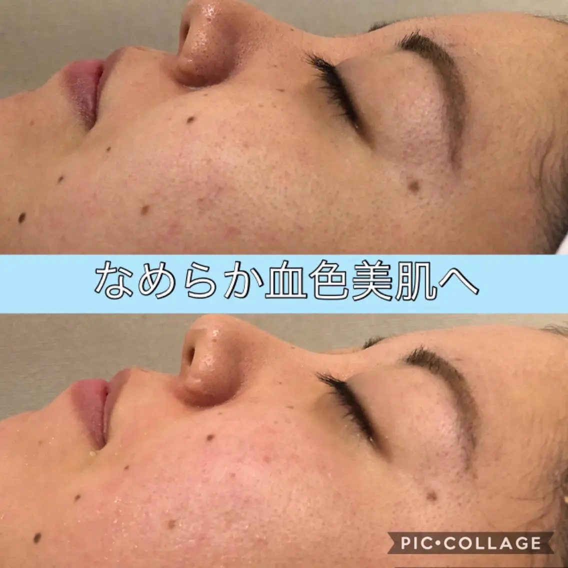 ロング カラー パーマ ヘアアレンジ キッズ ネイル マツエク・マツパ エステ リラク EnsorClair 代表　野口真央のエステ・リラクイメージ