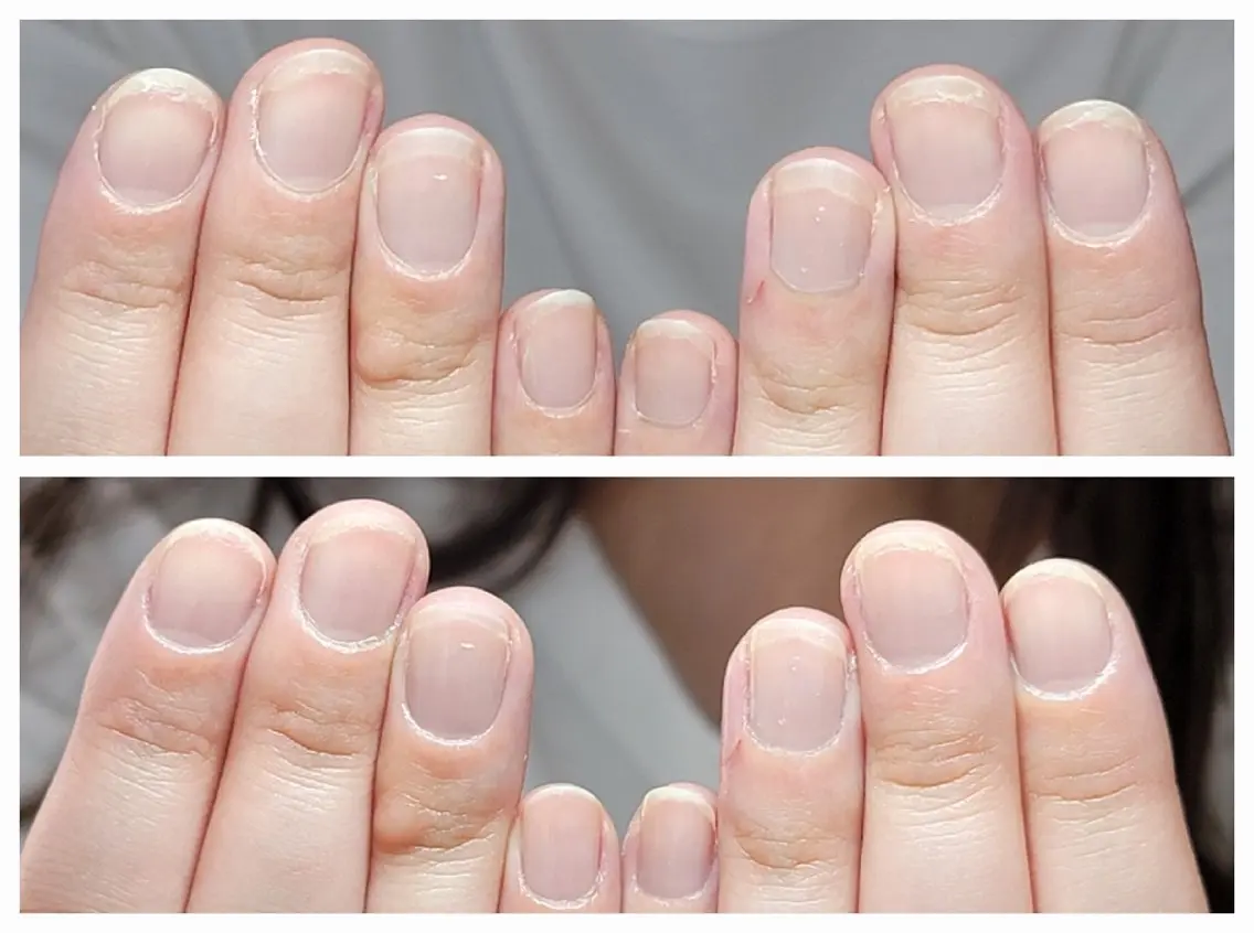 ネイル ネイル&巻き爪サロン AKnailのネイルデザイン
