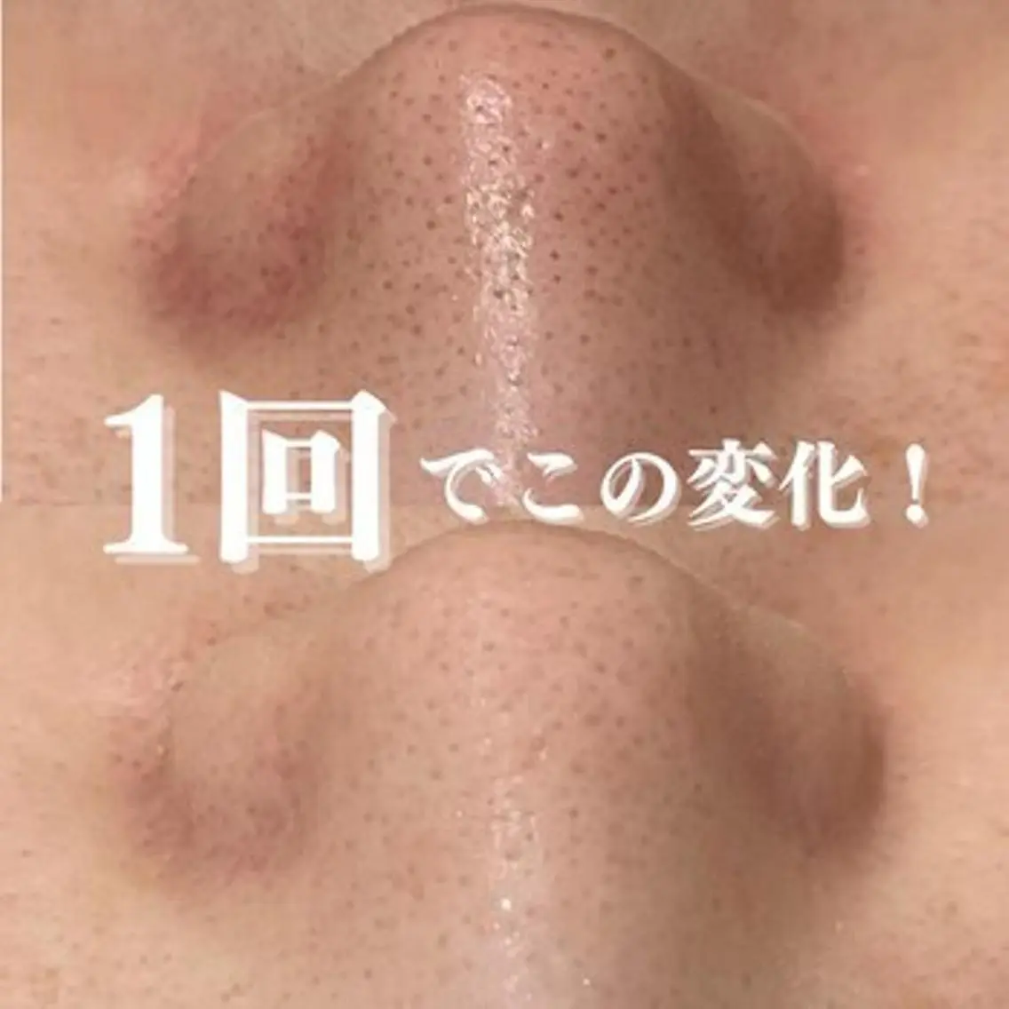 3か月で肌革命👼 ニキビ専門店💫のエステ・リラクイメージ