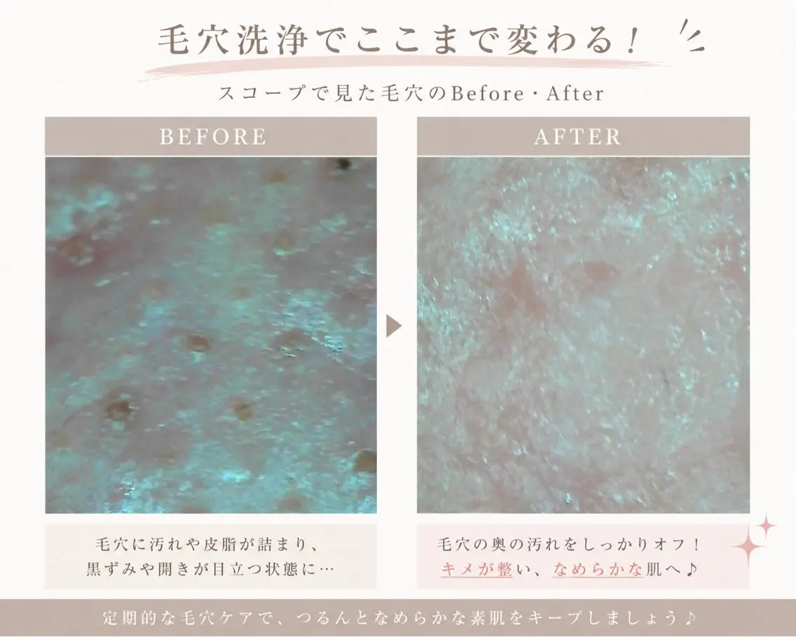 エステ i’m este あまねのエステ・リラクイメージ