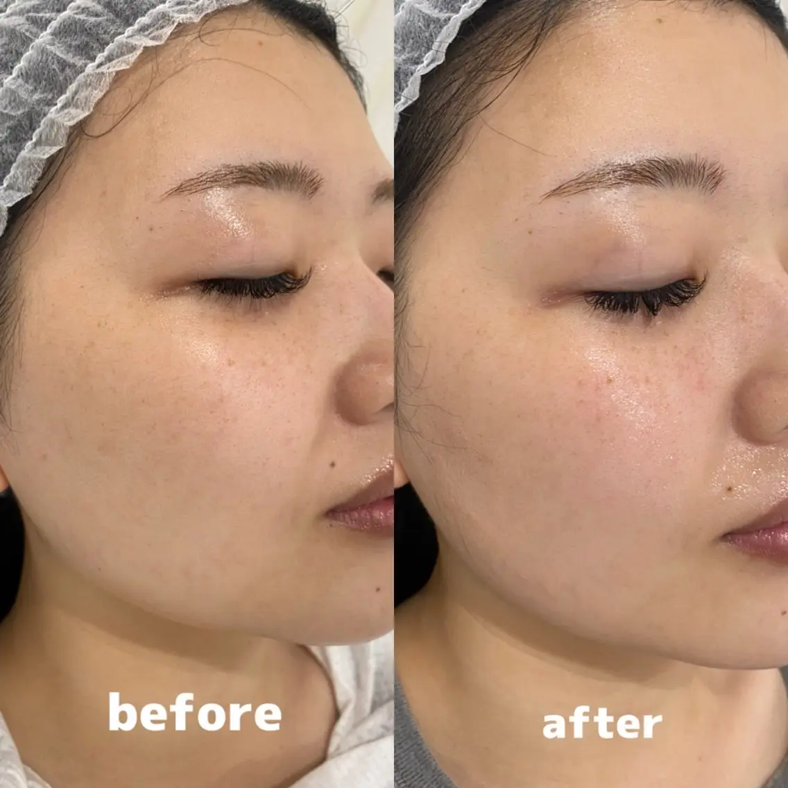 Whitening Beauty 行橋店のその他イメージ