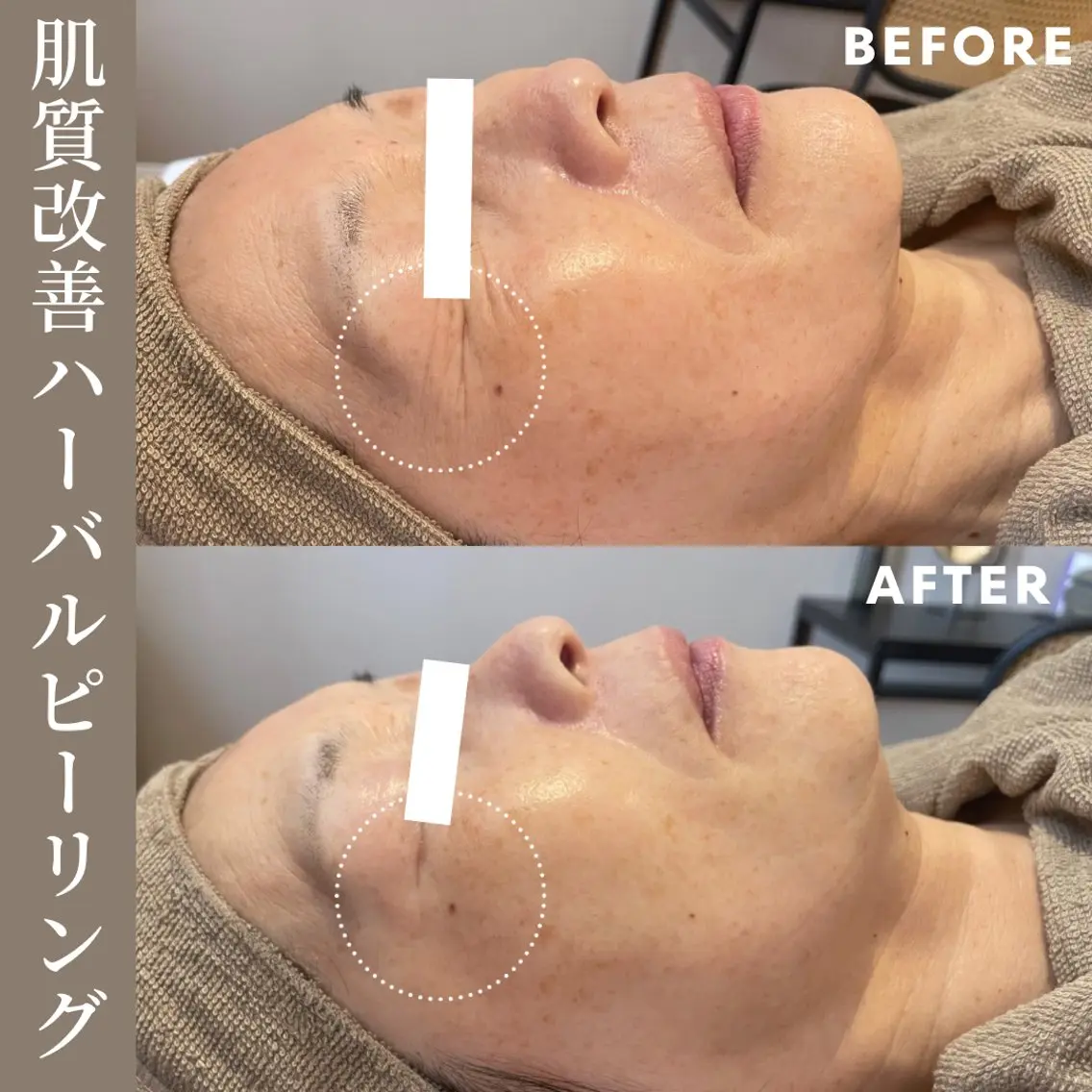 エステ Lassy Yuriの眉毛・アイブロウイメージ