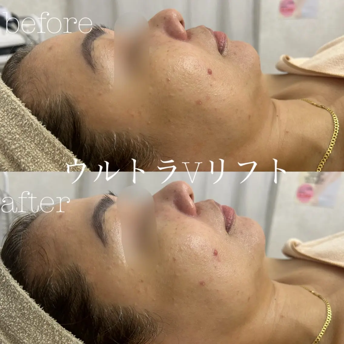 エステ フェイシャルサロン CHIARA 荒田のエステ・リラクイメージ