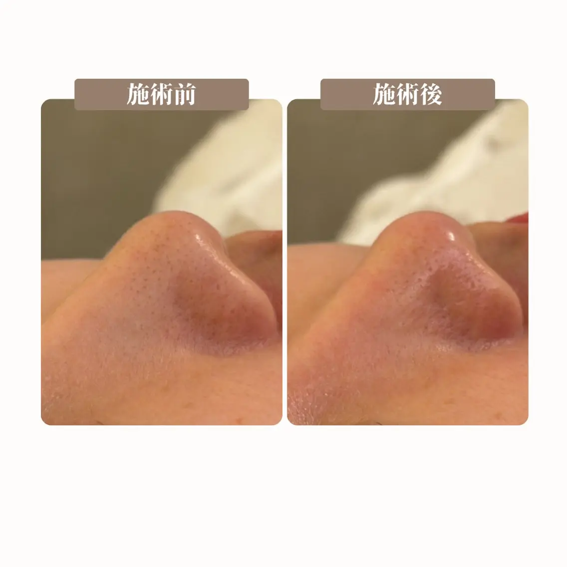 エステ BLANCIA 銀座のエステ・リラクイメージ