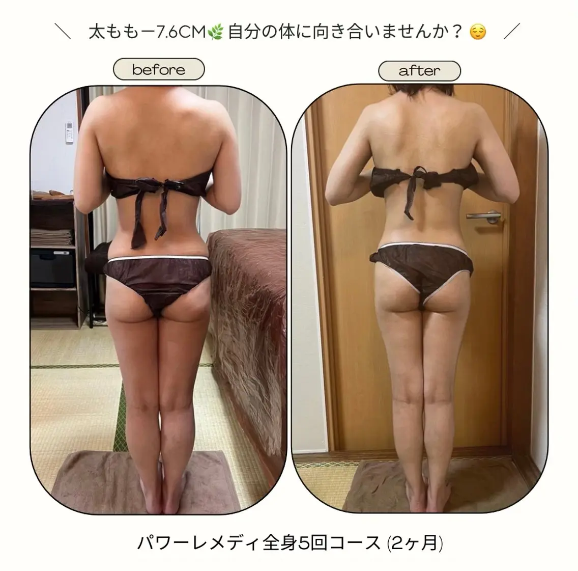 《本気痩せ×疲労改善 》  BILOOPのエステ・リラクイメージ