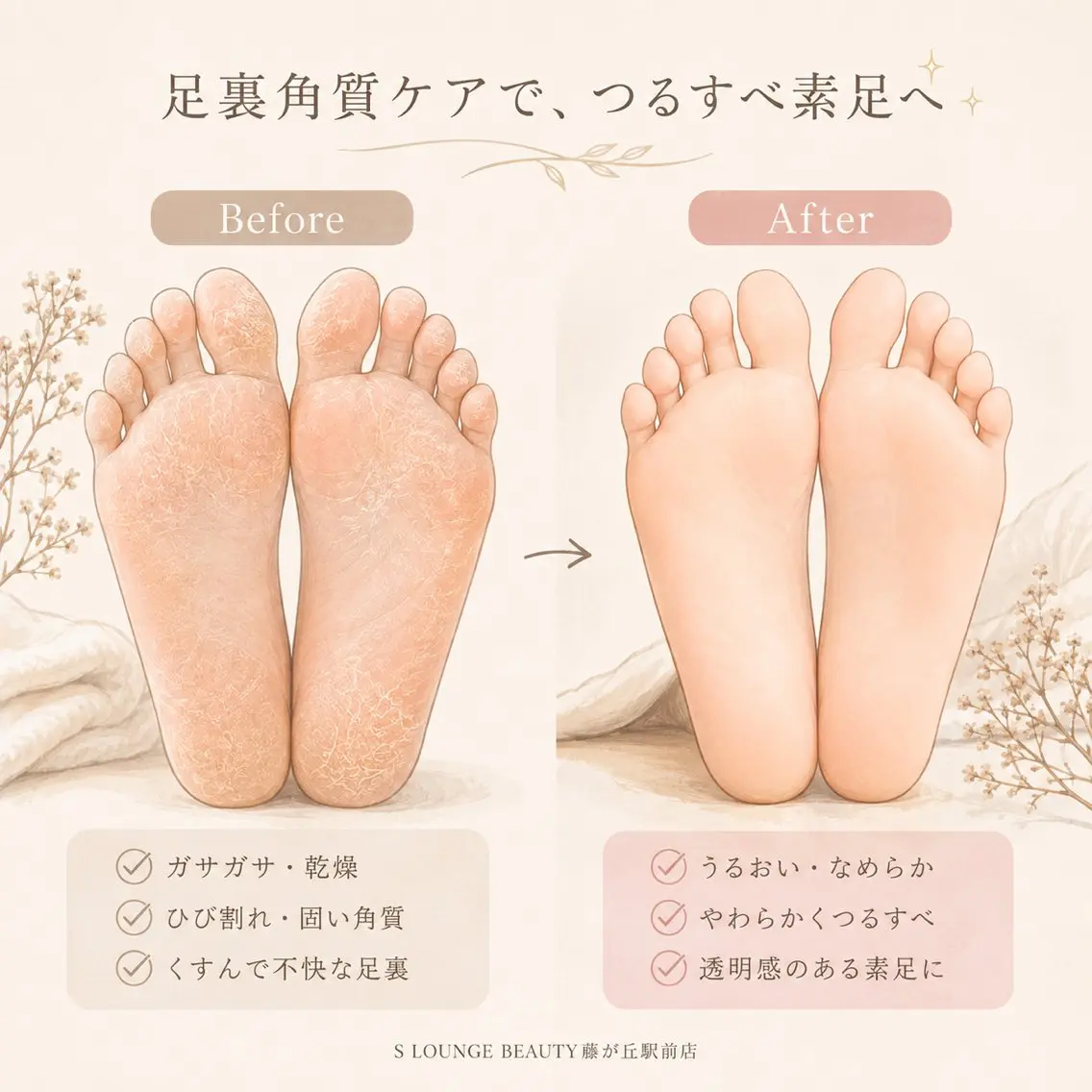 その他 耳つぼ💎エステ kimiのその他イメージ