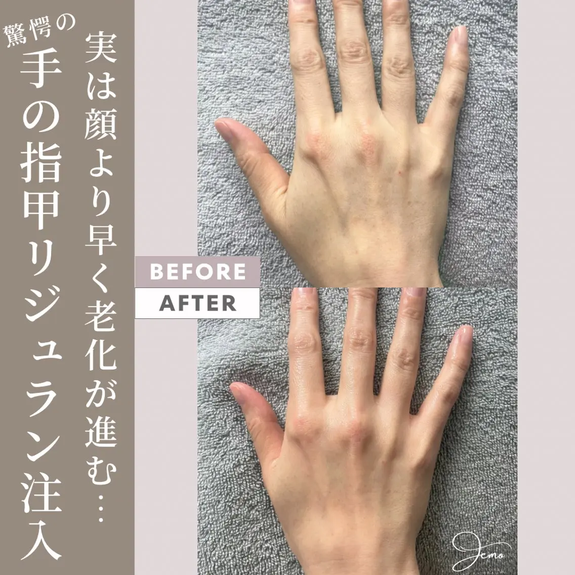 脱毛増毛肌管理サロン Jemoのエステ・リラクイメージ