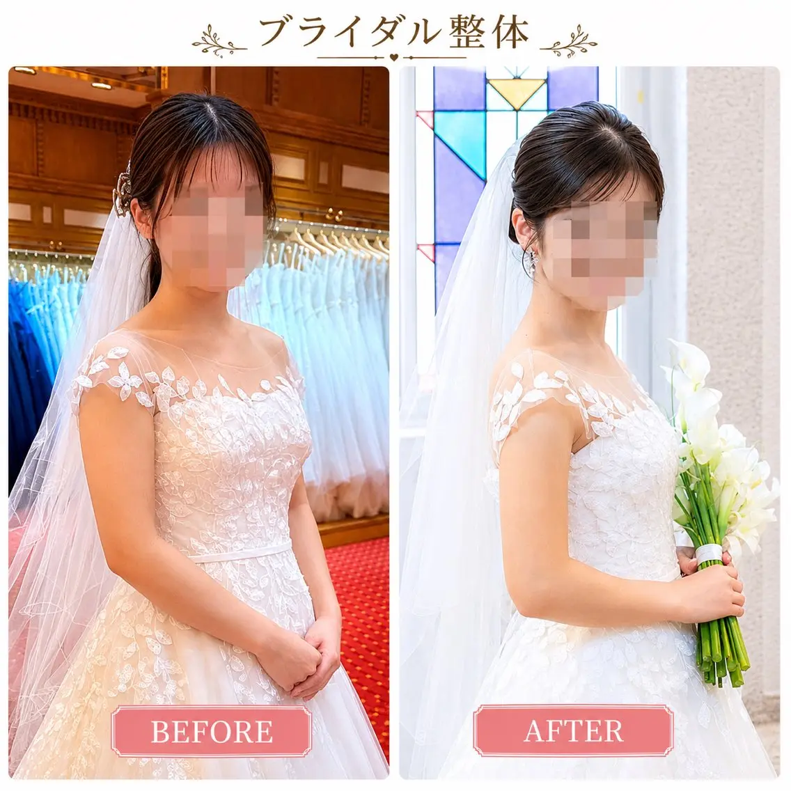 ブライダル・美容整体 にしやま整骨院のエステ・リラクイメージ