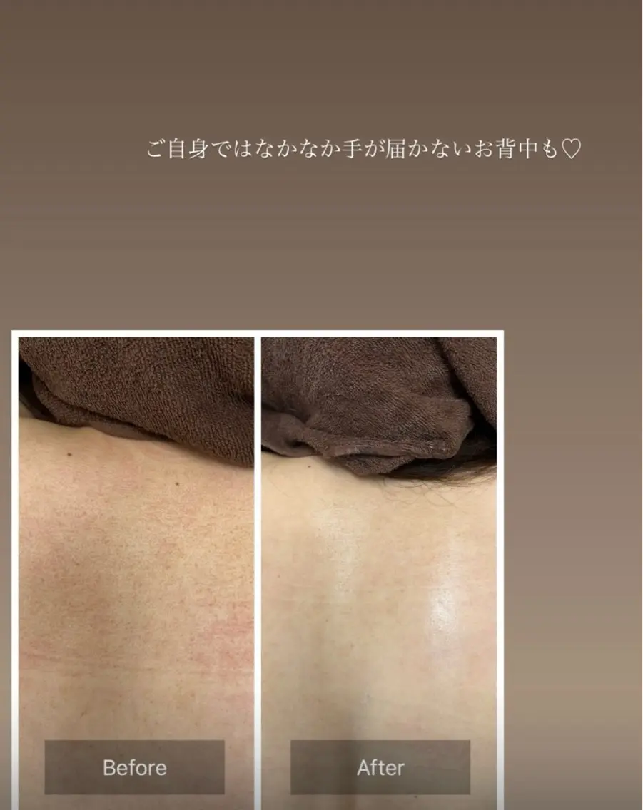 天使の 艶肌のエステ・リラクイメージ
