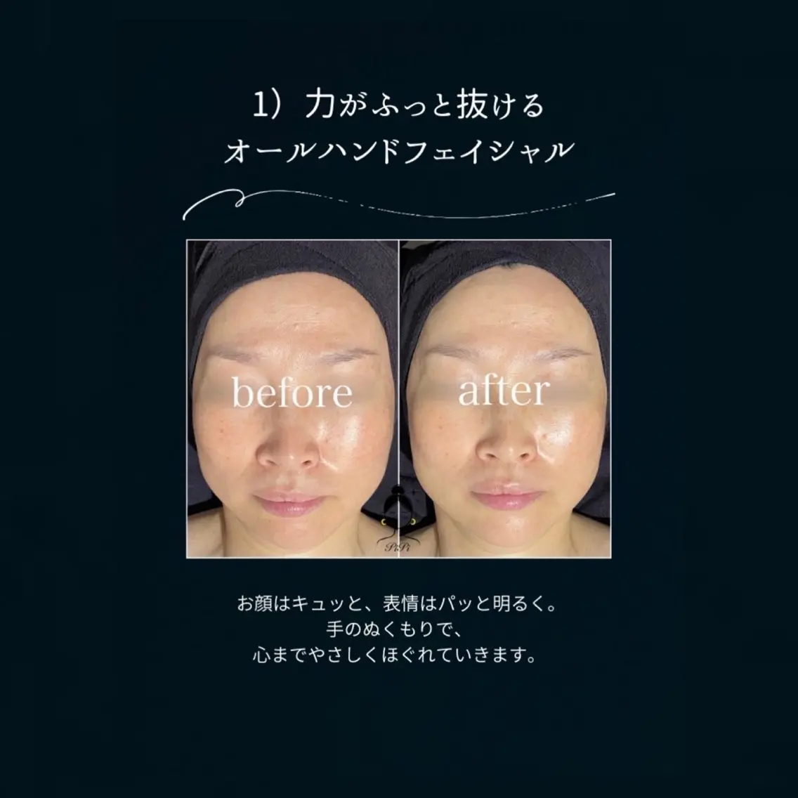 エステ リラク 小顔マッサージ🌙 Hiyoriのエステ・リラクイメージ