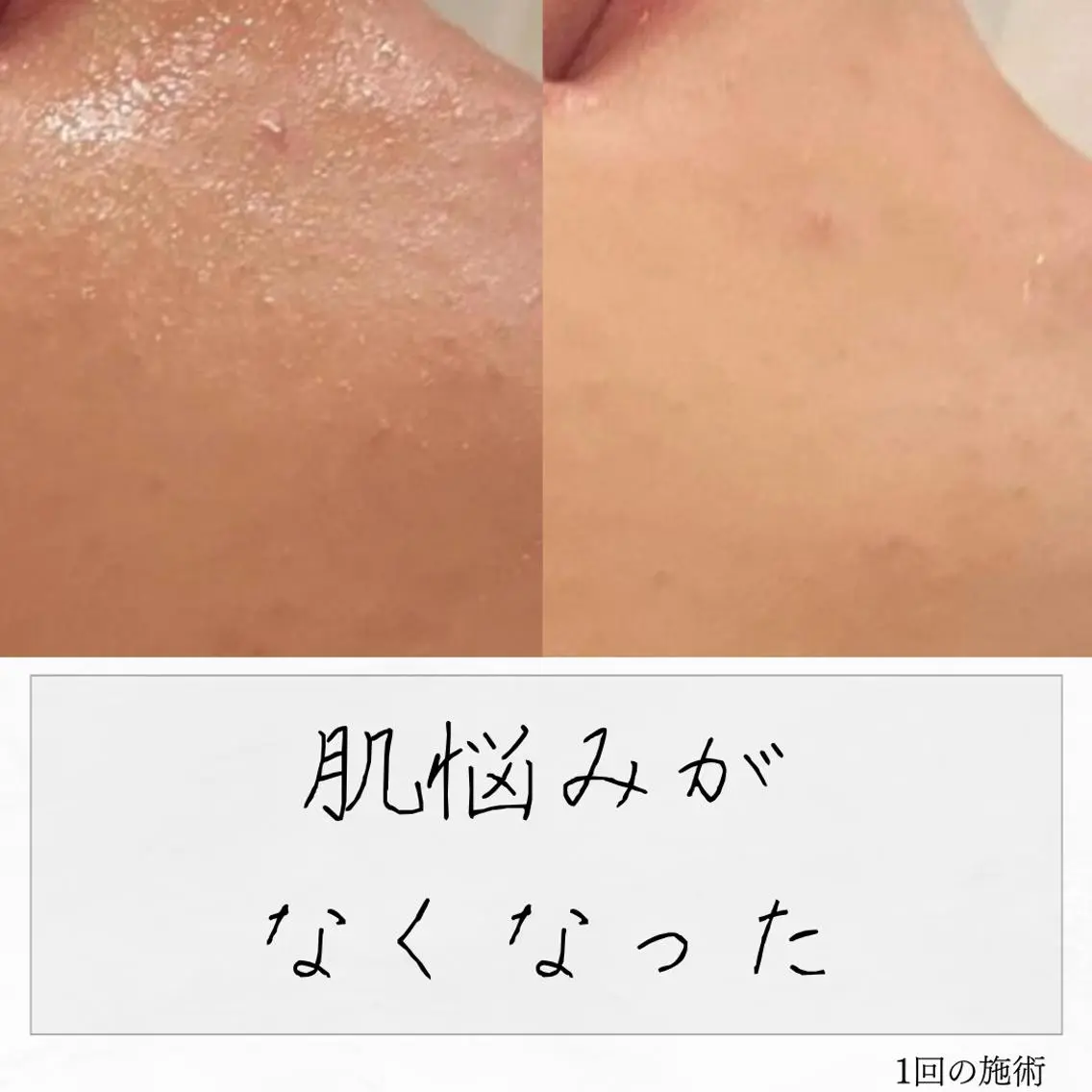 ニキビ経験者が施術 する専門サロン🌻のエステ・リラクイメージ