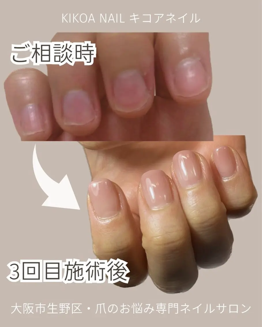ネイル KIKOA NAIL キコアネイルのネイルデザイン