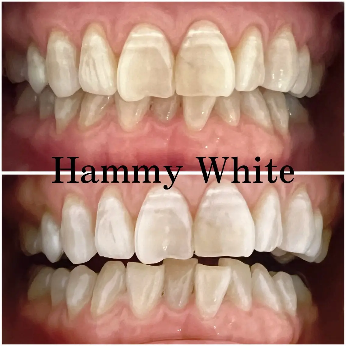 その他 HammyWhite 心斎橋🌈AMIのその他イメージ
