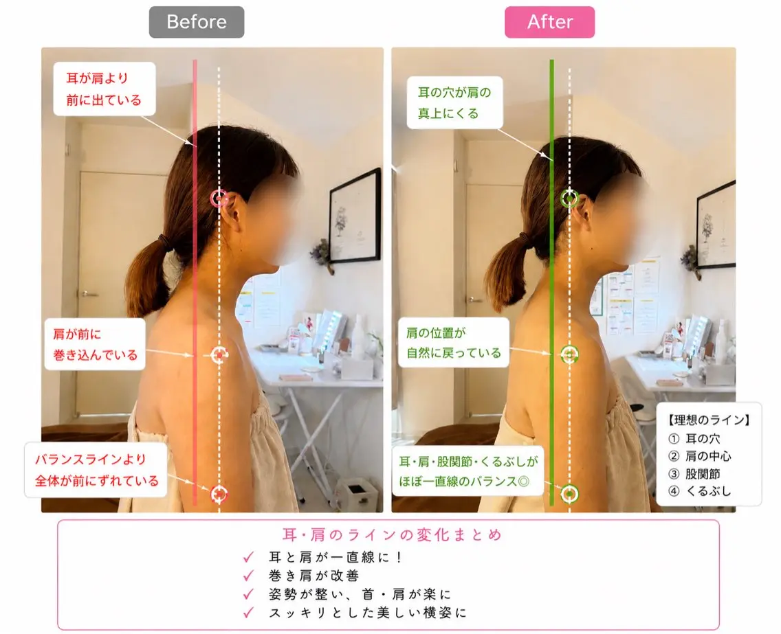人気No.1‼️  【全身が生まれ変わる】極上デトックス120分✨の写真