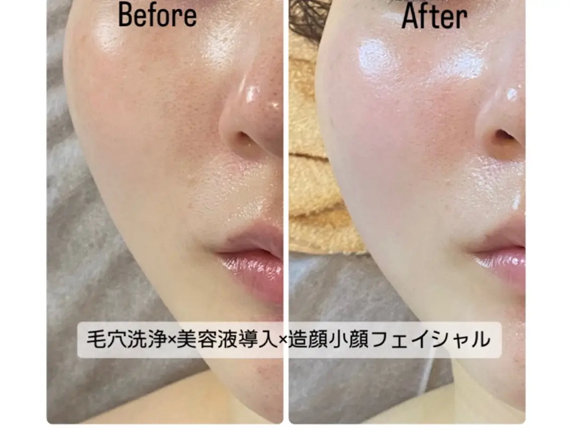 脱毛・エステサロン LuLuNのエステ・リラクイメージ