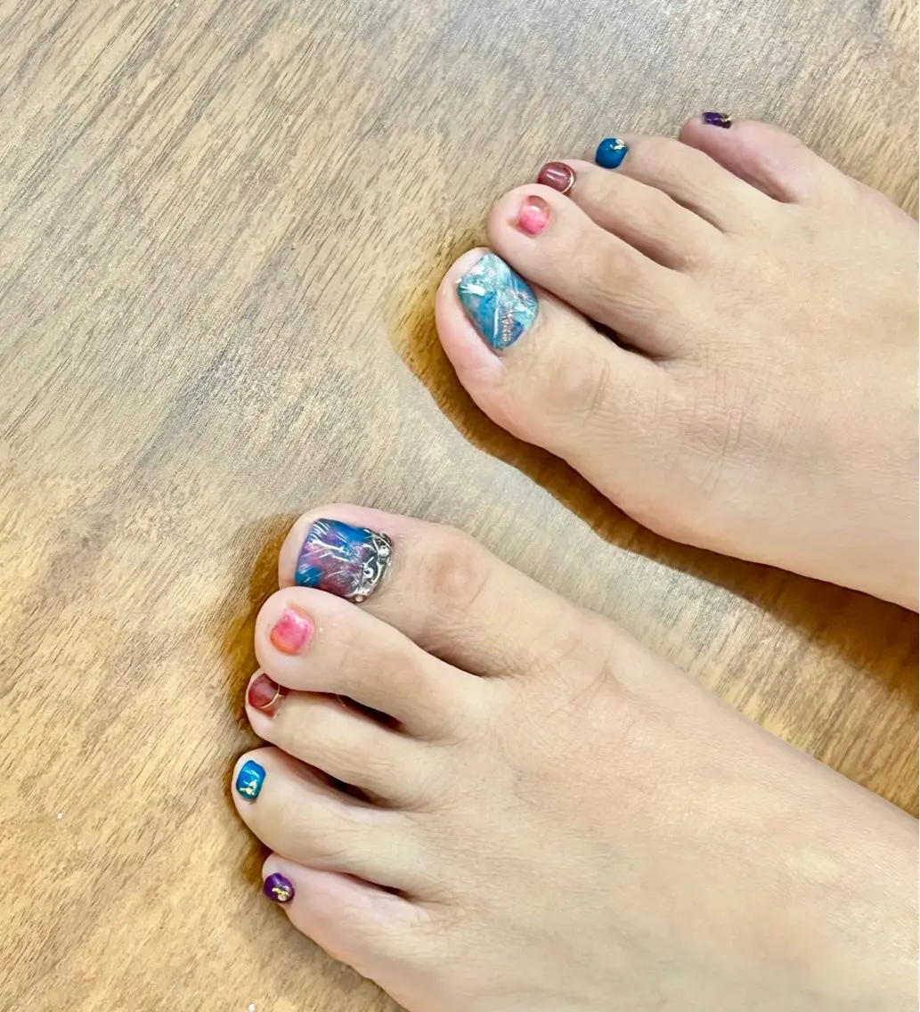 B/S巻き爪ケア(1本)の写真