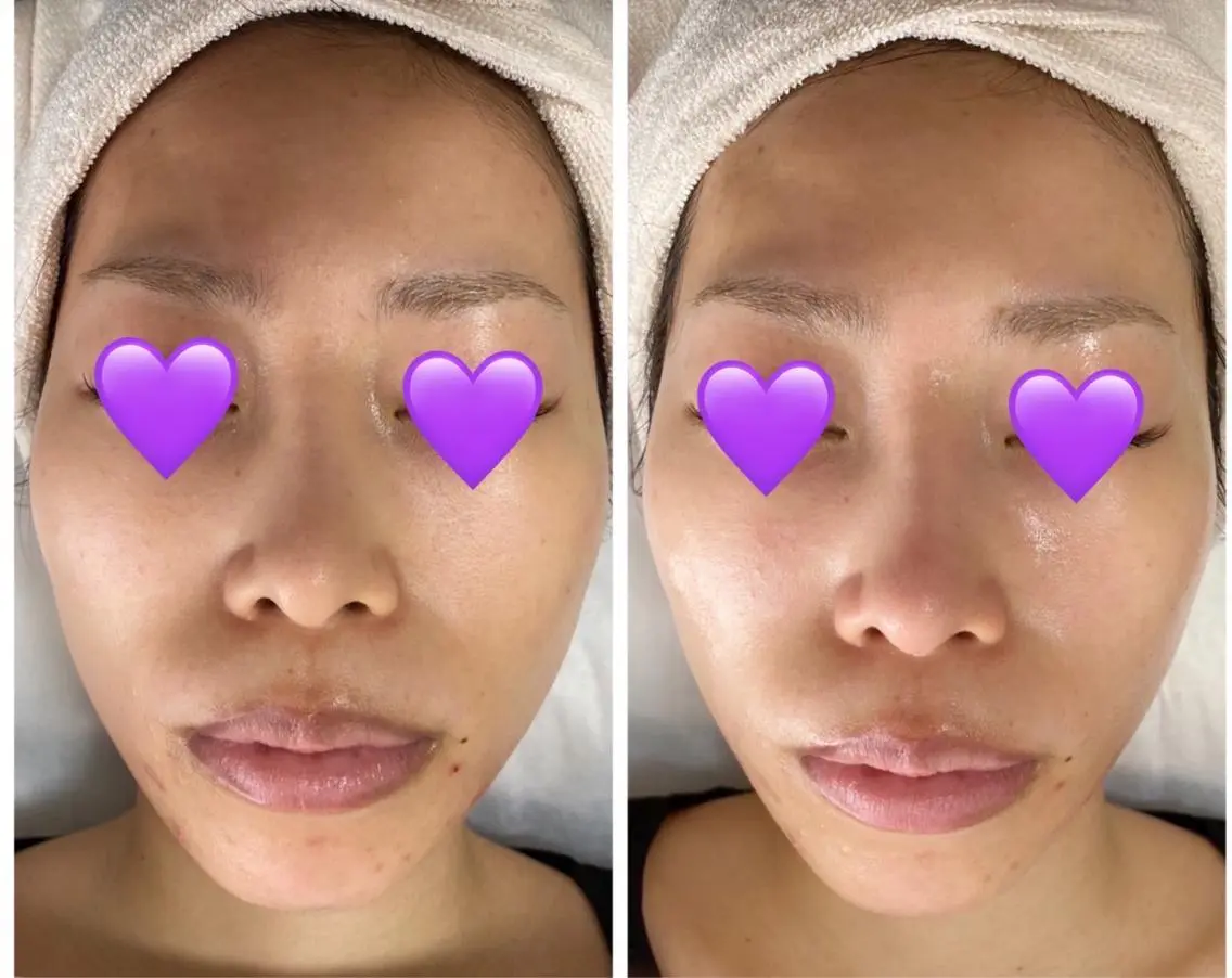 COCO beautyサロンのエステ・リラクイメージ