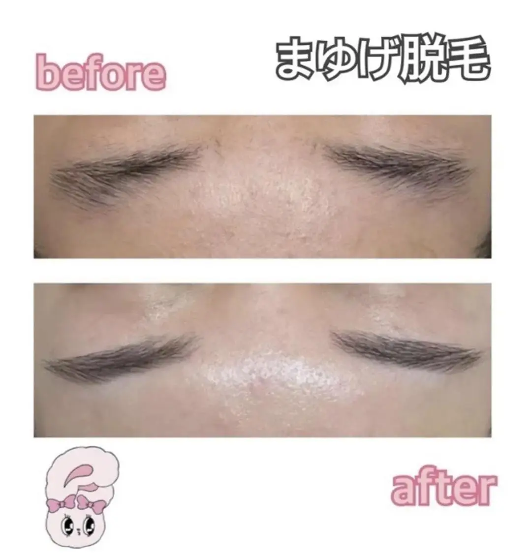 🌷毛穴エステ レイビスMURA🌷のエステ・リラクイメージ