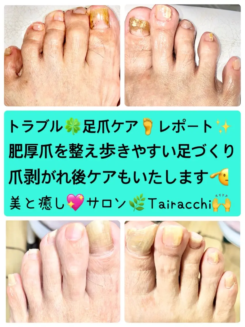 ネイル フットネイル Tairacchi ﾀｲﾗｯﾁのエステ・リラクイメージ