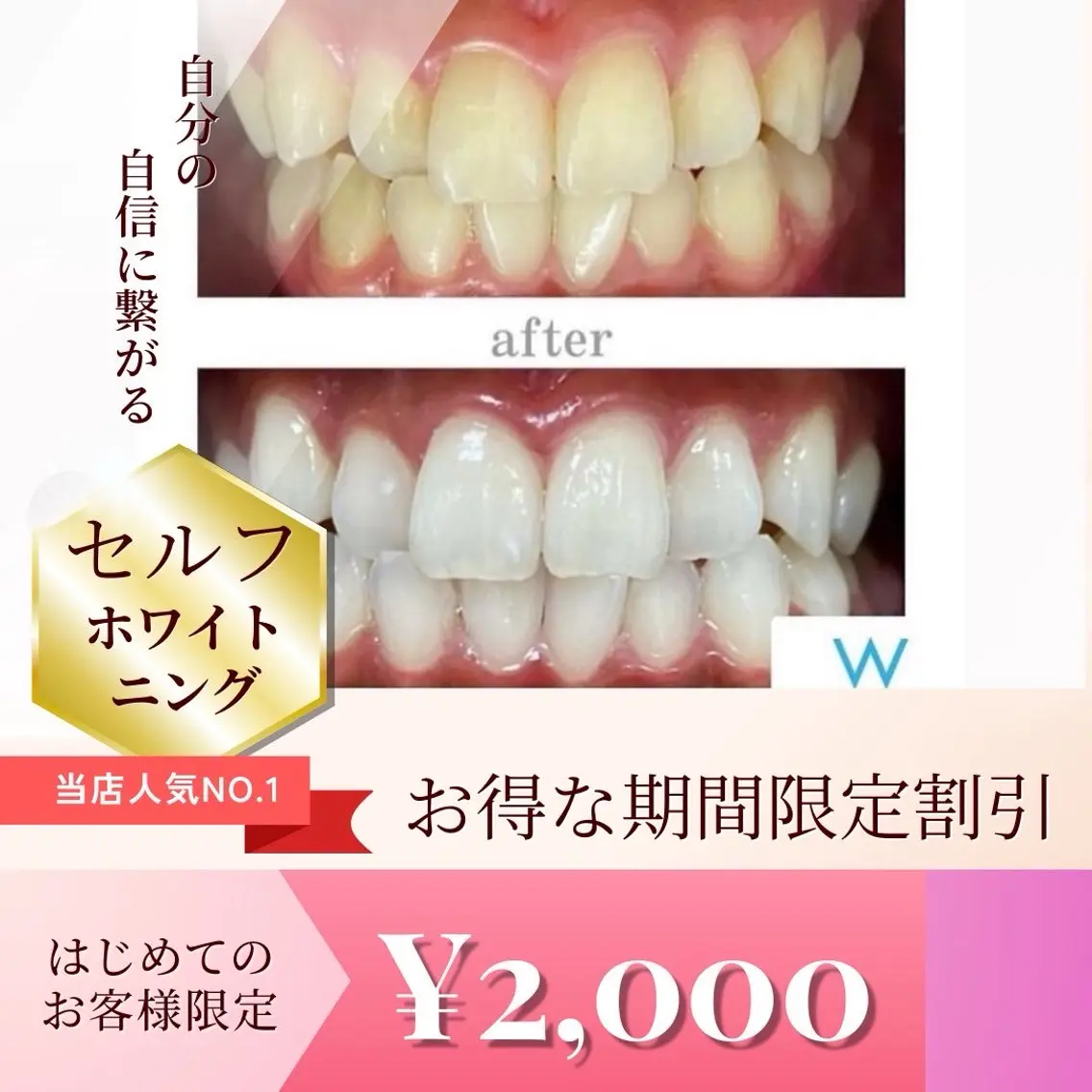 キッズ その他 ホワイトニング ショップ本厚木のその他イメージ