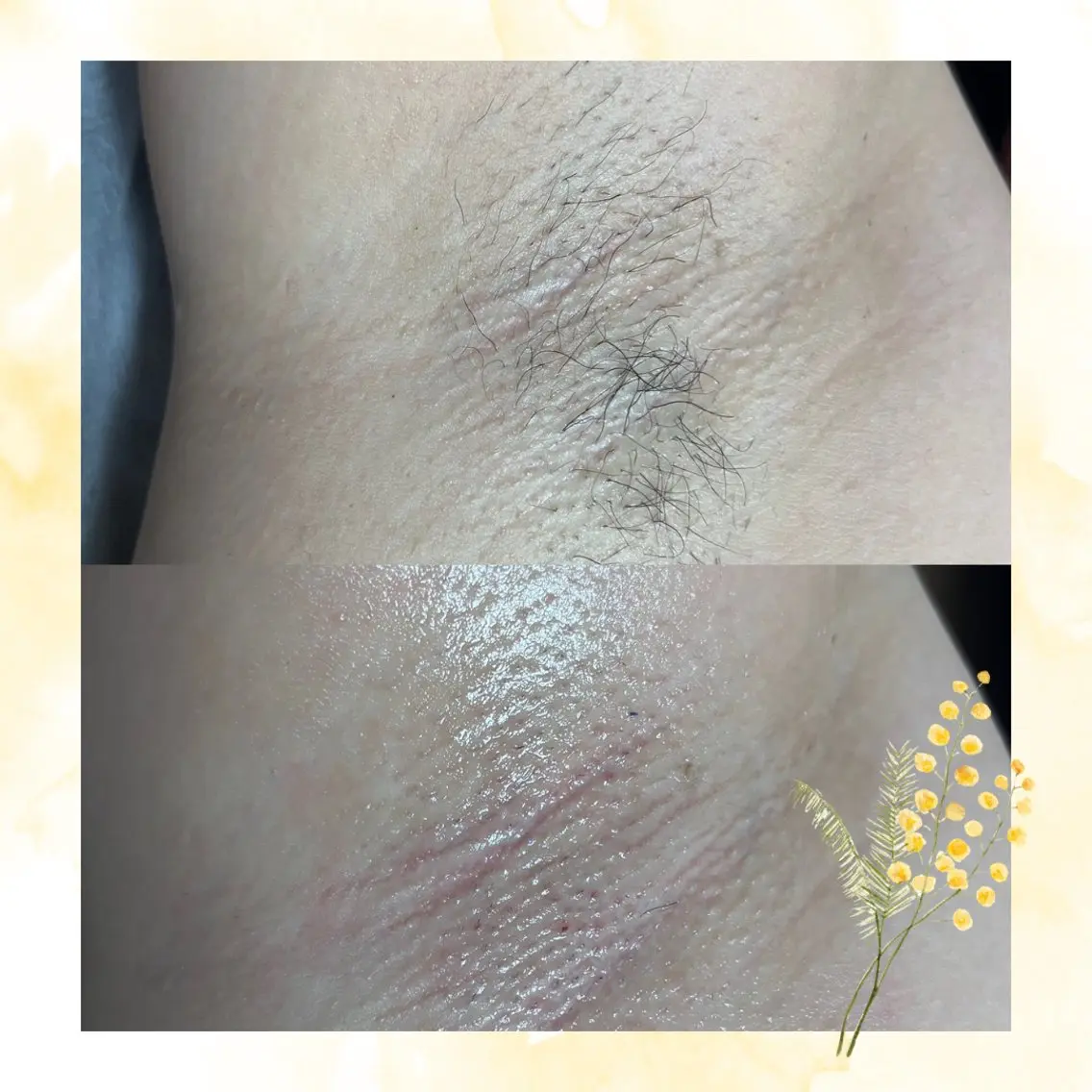 メンズ キッズ 脱毛 kaise makiのエステ・リラクイメージ