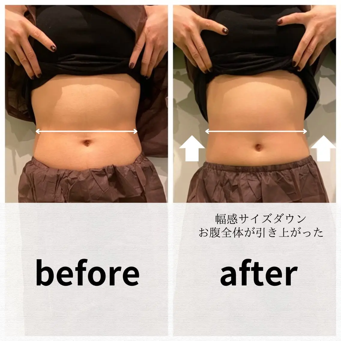 美容鍼/ヘッドスパ/ 💎さかもとのエステ・リラクイメージ