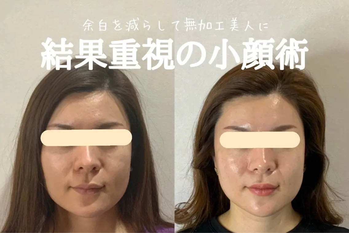 エステ リラク 最速小顔・肌質管理 espoirマキのエステ・リラクイメージ