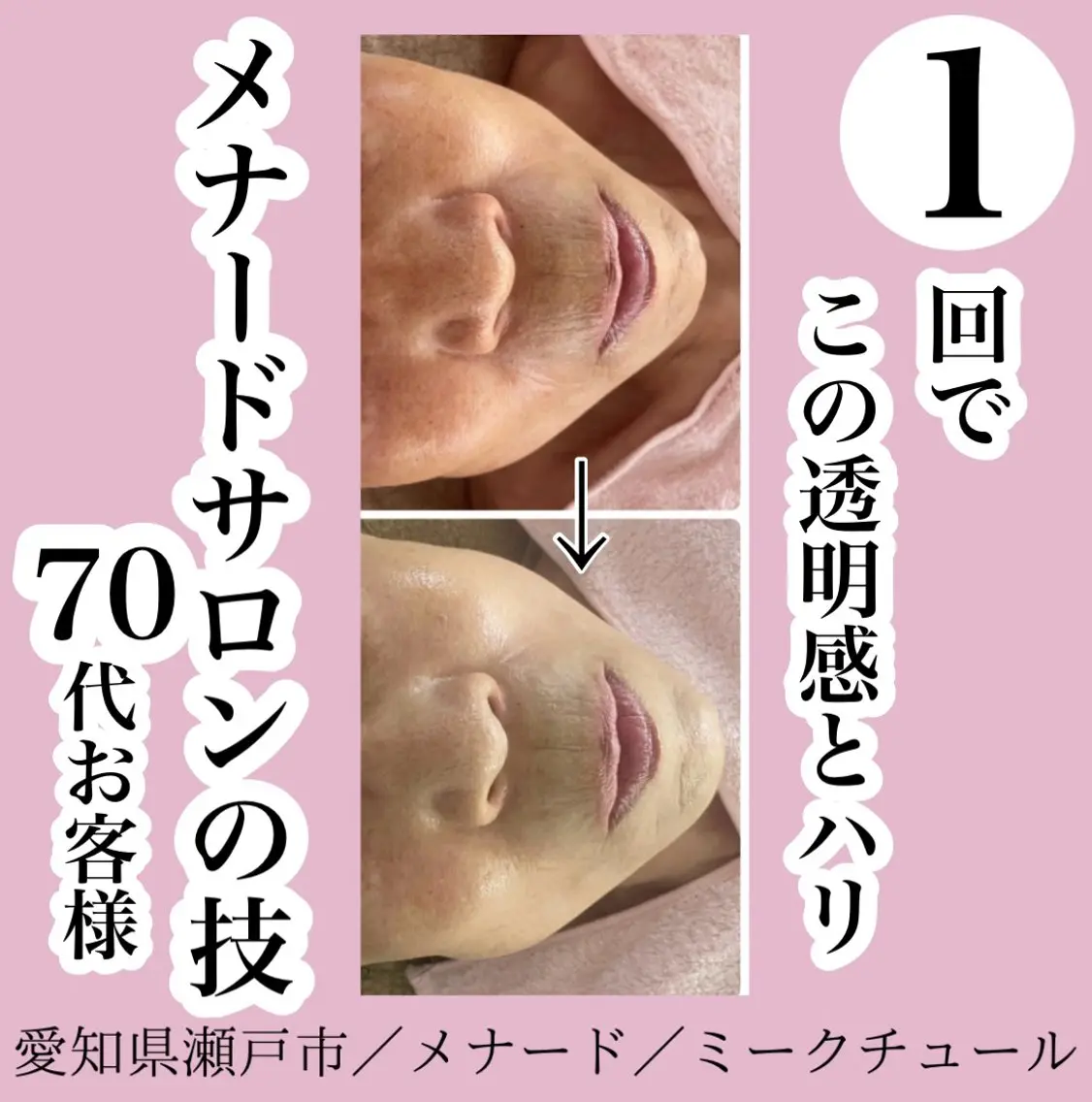 アドバンスコース＋シワ取りパック✨✨の写真