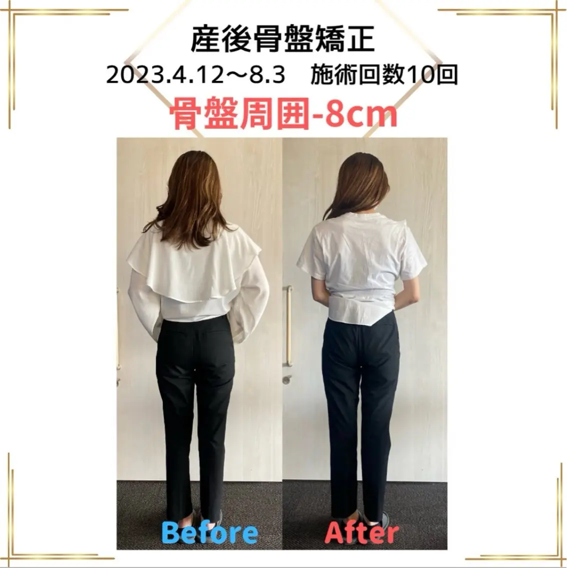 【産後半年以内のママさん！】産後骨盤矯正の写真