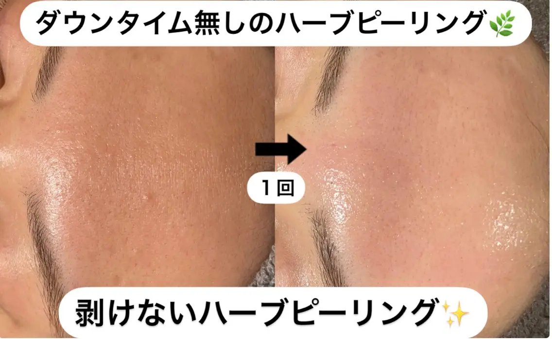 エステ 横田 汐里のネイルデザイン