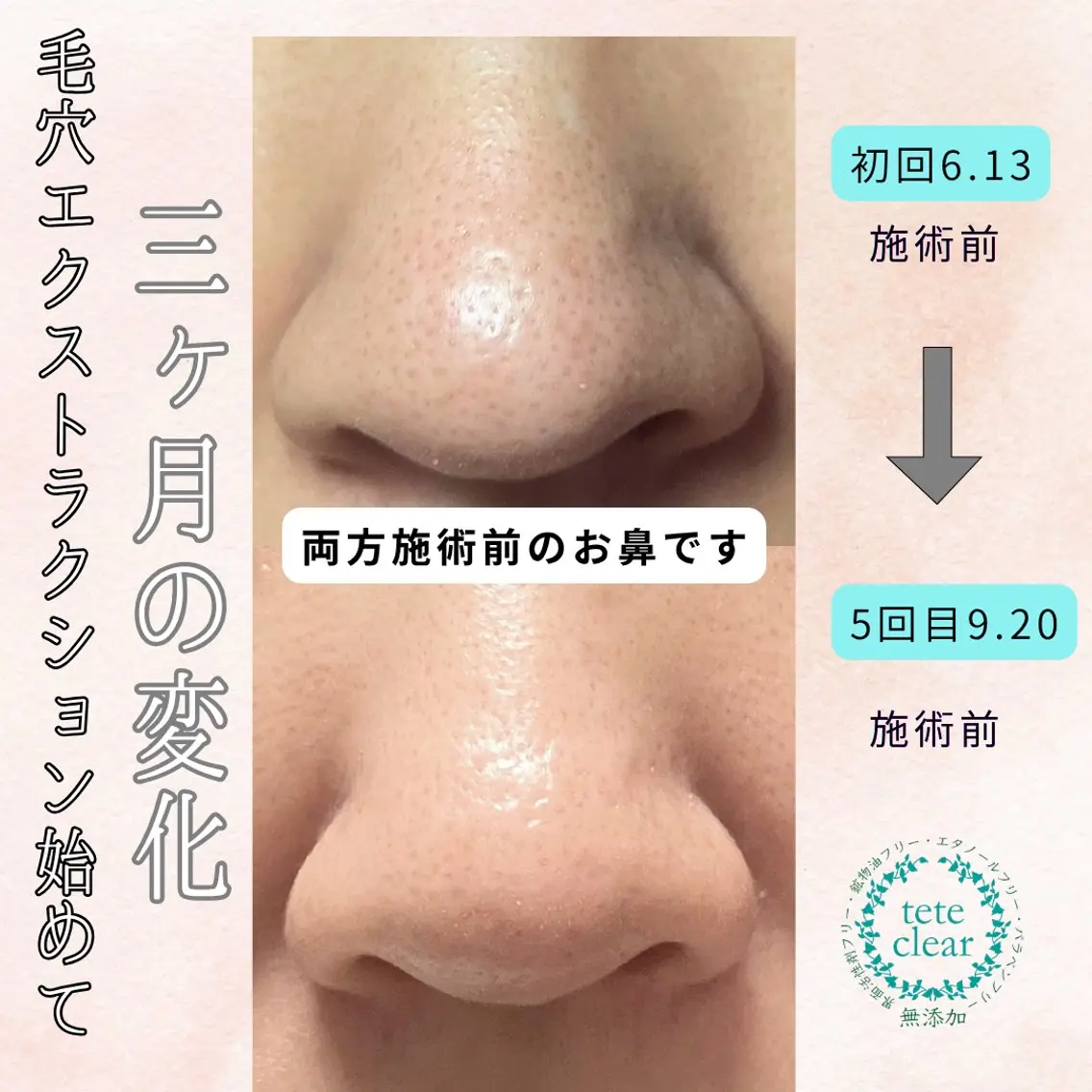 エステ SOLEILnail &beautyのエステ・リラクイメージ