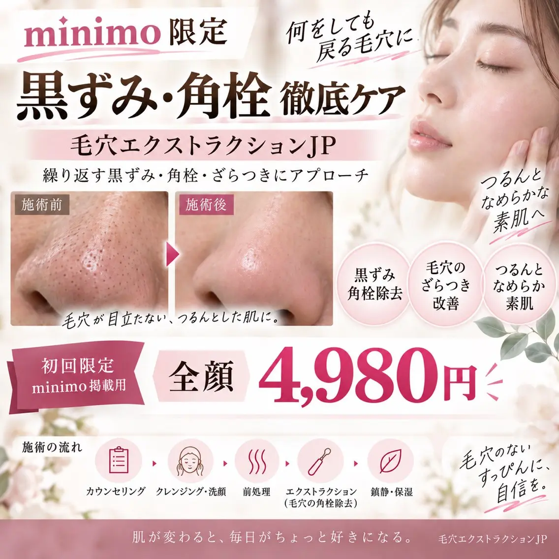 全顔毛穴エクストラクションの写真