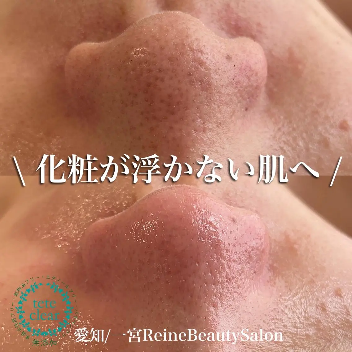 毛穴/シミ肝斑/脱毛 横山梨里のエステ・リラクイメージ