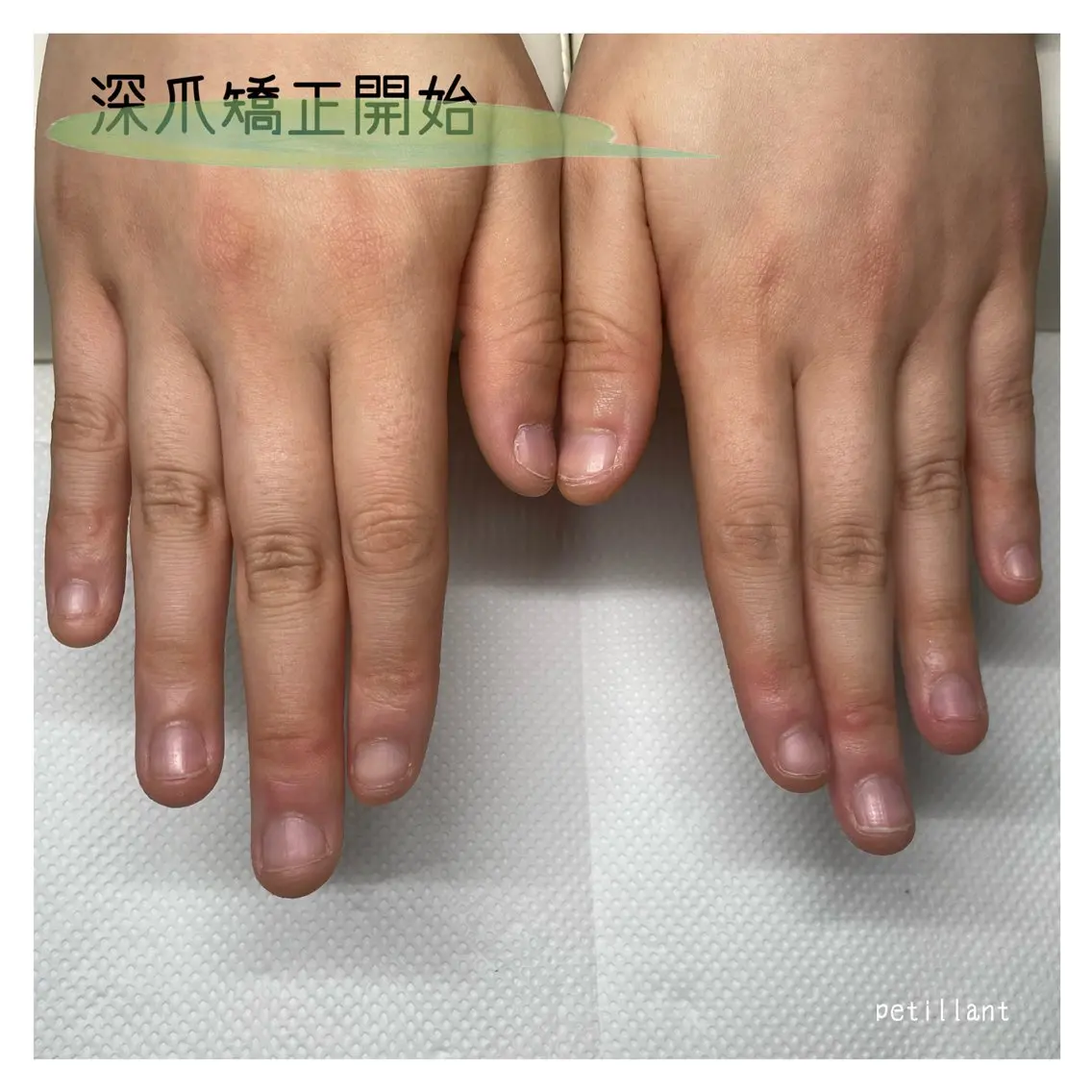 ネイル nail salon petillantのネイルデザイン