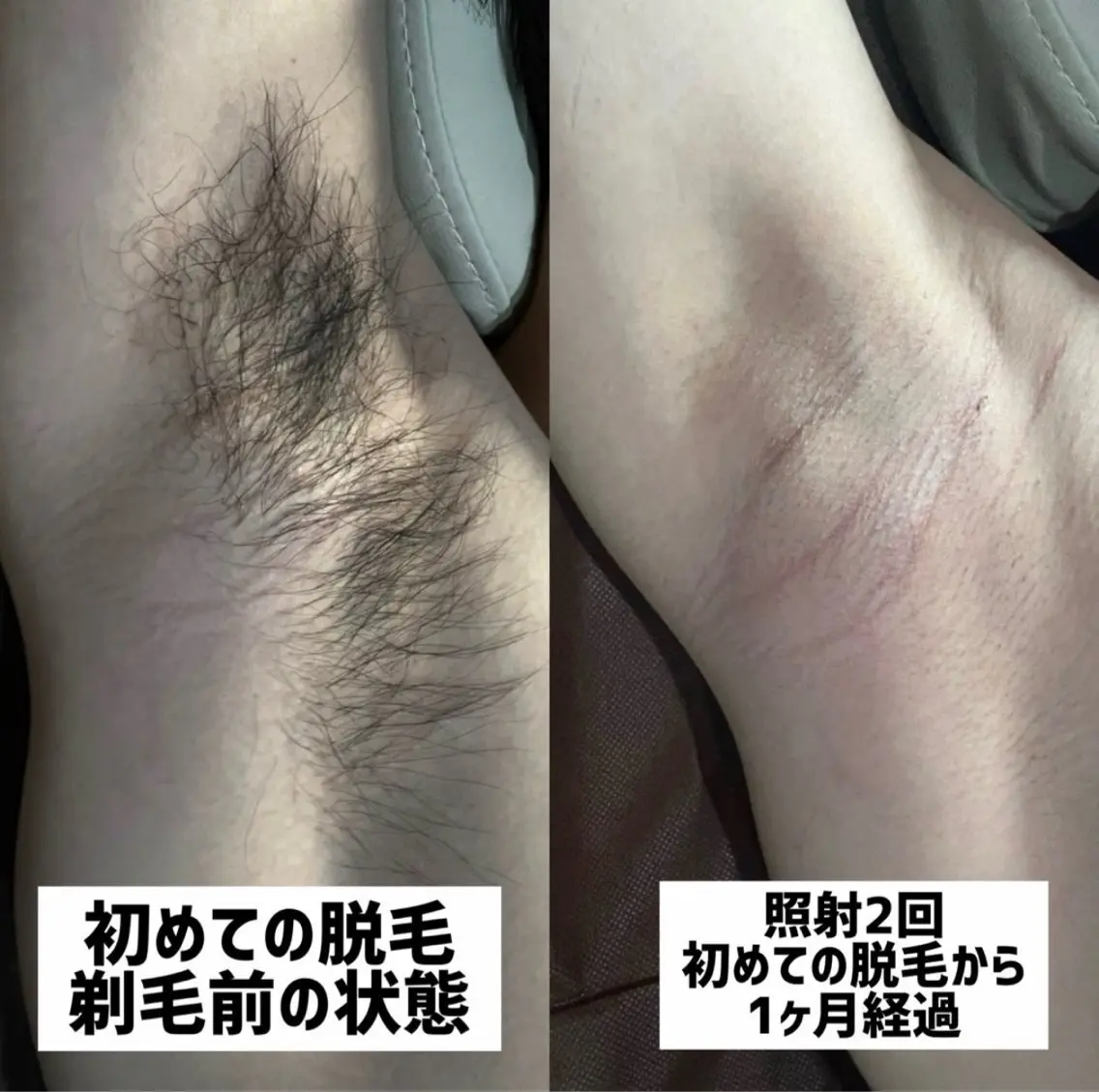 Mr.&Ms.脱毛 /眉毛ワックスひなたの眉毛・アイブロウイメージ