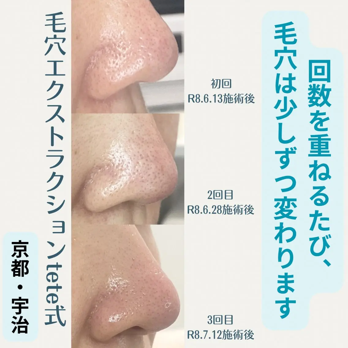ネイル エステ 粟津 美紀のエステ・リラクイメージ